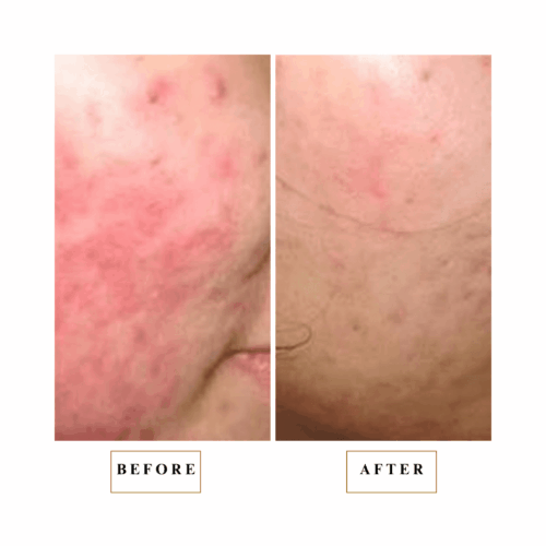 CS12 Before After_2021 Salon Customer Sabrina