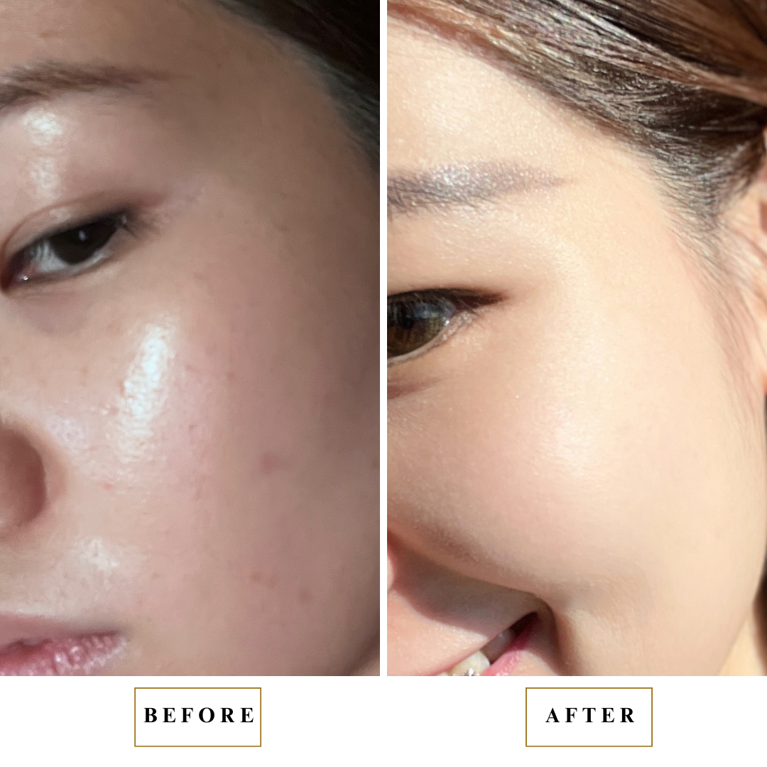 CS12 Before After Miracle Mask_Momo
