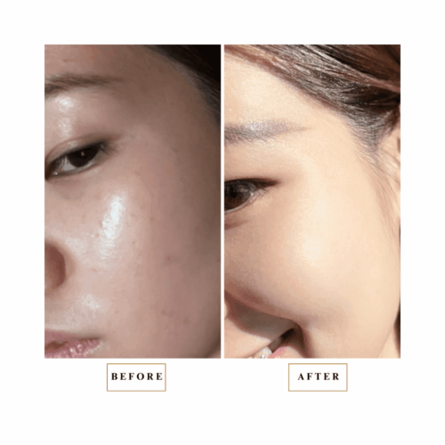 CS12 Miracle Mask_MOMO_Reviews