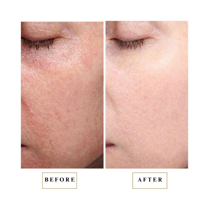 Ampoule customer before after-1