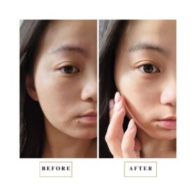 CS12_Ting-Ting_sensitive skin_miracle mask_before after