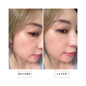 kamama ampoule before after